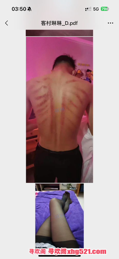 035633brxz5ks5s2s2562i.png
